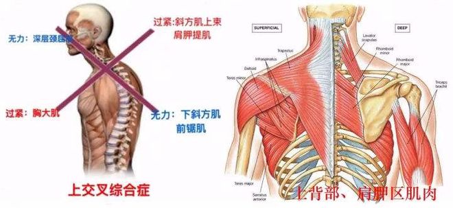 6686体育含胸驼背怎么办？这套动作帮你增强上背及颈肩部肌肉力量(图1)